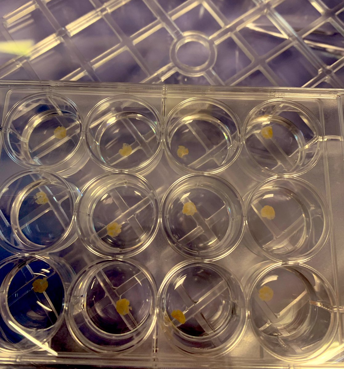 Paula Boeira, PhD (@paula__boeira) on Twitter photo Back to slicing 🔪🧫
5 livers coming this week 😁☠️
#precisioncutliverslices #PCLS #liverresearch <a href="/HepatoPlymouth/">Hepatology Plymouth</a> Back to slicing 🔪🧫
5 livers coming this week 😁☠️
#precisioncutliverslices #PCLS #liverresearch <a href="/HepatoPlymouth/">Hepatology Plymouth</a>