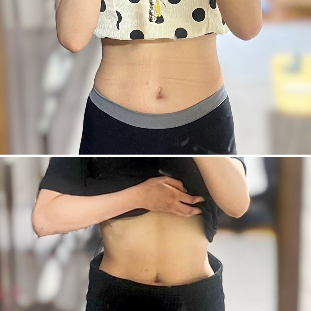 MILLダイエットクリニック🍊 (@Gyul_diet) / X MILLダイエットクリニック🍊 (@Gyul_diet) / X