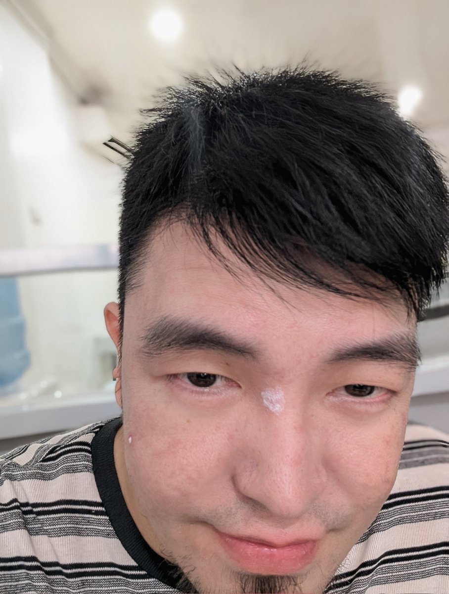 SHINRELUCIO's tweet photo. Those bumps, scars, spots, lines, colors and textures that the beauty world tells you are "problem skin," but are actually what makes you unique. Imperfections are attractive when their owners are happy with them. 😊 https://t.co/WeuSGc7hIz