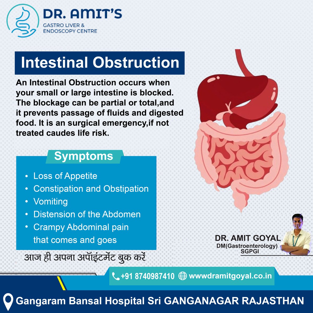 dramitgoyal24's tweet photo. 🚨 Intestinal Obstruction: Know the Signs &amp; Seek Immediate Help🚨

Symptoms to watch out for:
- Loss of Appetite🍽️
- Constipation and Obstipation🚫
- Vomiting 🤢
- Abdominal Distension🌟
- Crampy Abdominal Pain that comes and goes💥

Don't ignore these signs!🌟 
 +91 87409-87410 https://t.co/PMjioZSdob