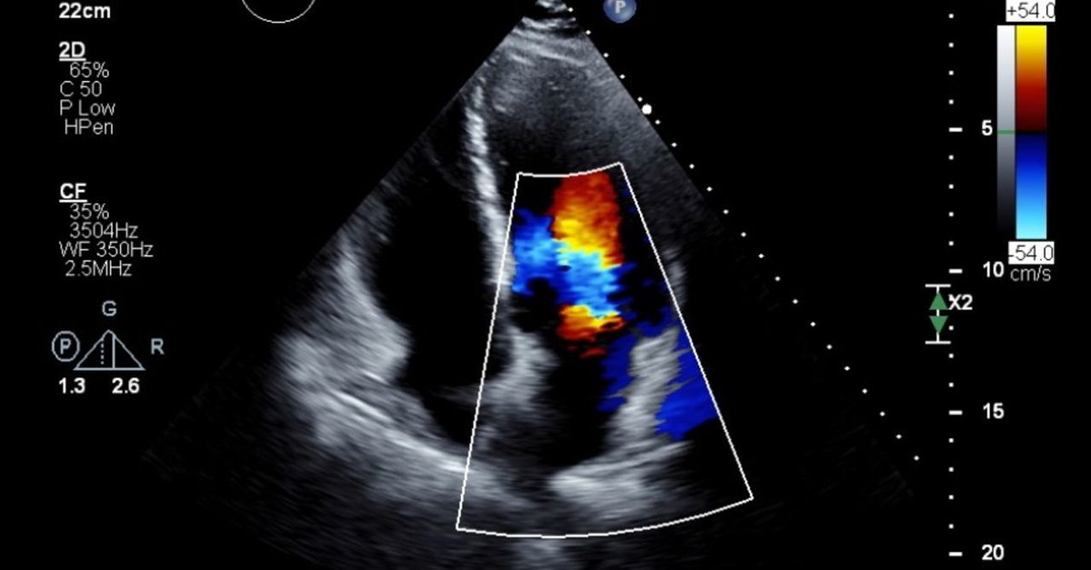 A new study has discovered the potential for AI to transform care for heart failure patients. A team from our School, led by Dr Ify Mordi, and working with Red Star AI, identified alternative and more effective treatment plans for patients. Read more: buff.ly/4eb99iT