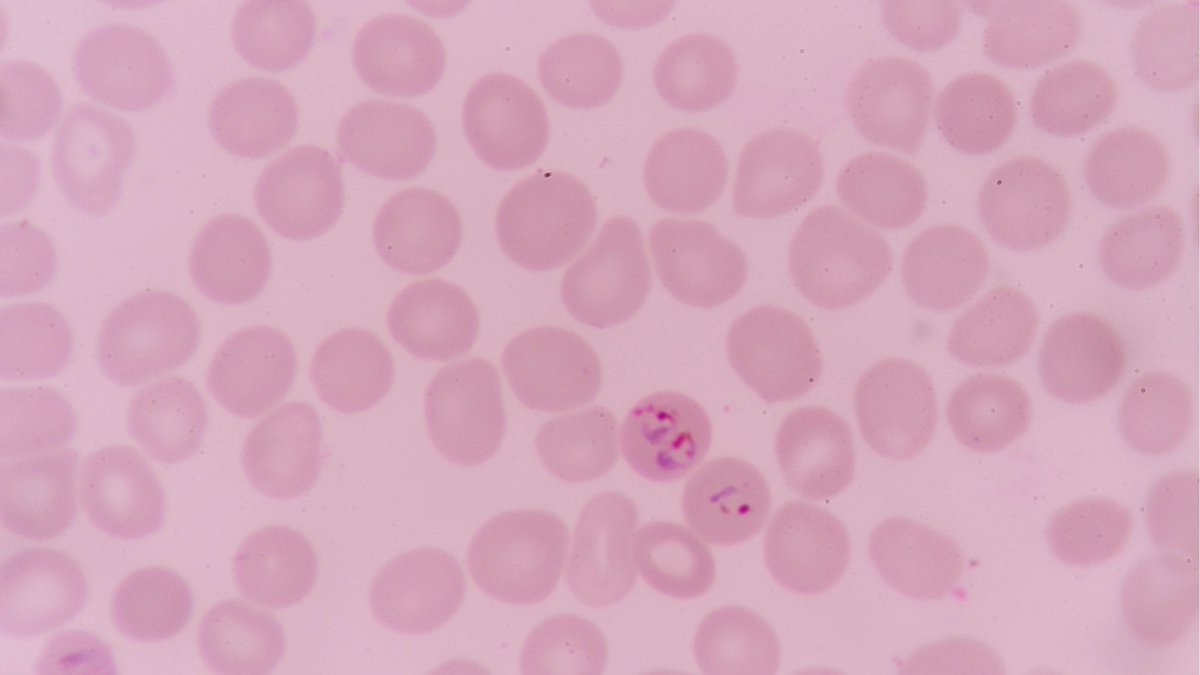 #CRISPRCas9 knockout screen used to identify metabolic host enzymes essential for the intracellular survival of Plasmodium and Theileria parasites, offering new opportunities for developing therapies.

More at <a href="/Nature/">nature</a>: shorturl.at/X617I