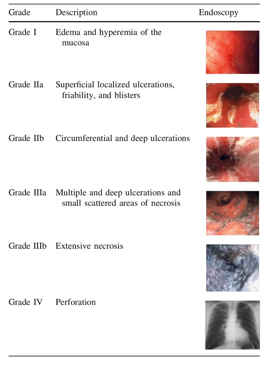 Zagar Classification (Caustic Injury, Lye Ingestion)