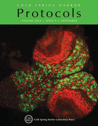 Jason Tennessen (@tennessenlab) on Twitter photo Beautiful cover image from <a href="/TennessenLab/">Jason Tennessen</a> graduate student <a href="/iam_shef/">Shefali</a>! Congratulations!!!!! <a href="/IUBiology/">IU Biology</a> <a href="/GCDB_IU/">Genome Cell and Developmental Biology</a> Beautiful cover image from <a href="/TennessenLab/">Jason Tennessen</a> graduate student <a href="/iam_shef/">Shefali</a>! Congratulations!!!!! <a href="/IUBiology/">IU Biology</a> <a href="/GCDB_IU/">Genome Cell and Developmental Biology</a>