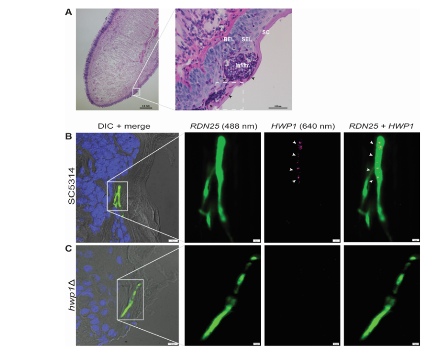Profiling fungal genes expressed in infected organs is important for understanding how Candida albicans causes disease. In <a href="/mSphereJ/">mSphere</a>: an approach to analyze spatiotemporal patterns of C. albicans gene expression at single-cell resolution in mouse tongues. asm.social/23l