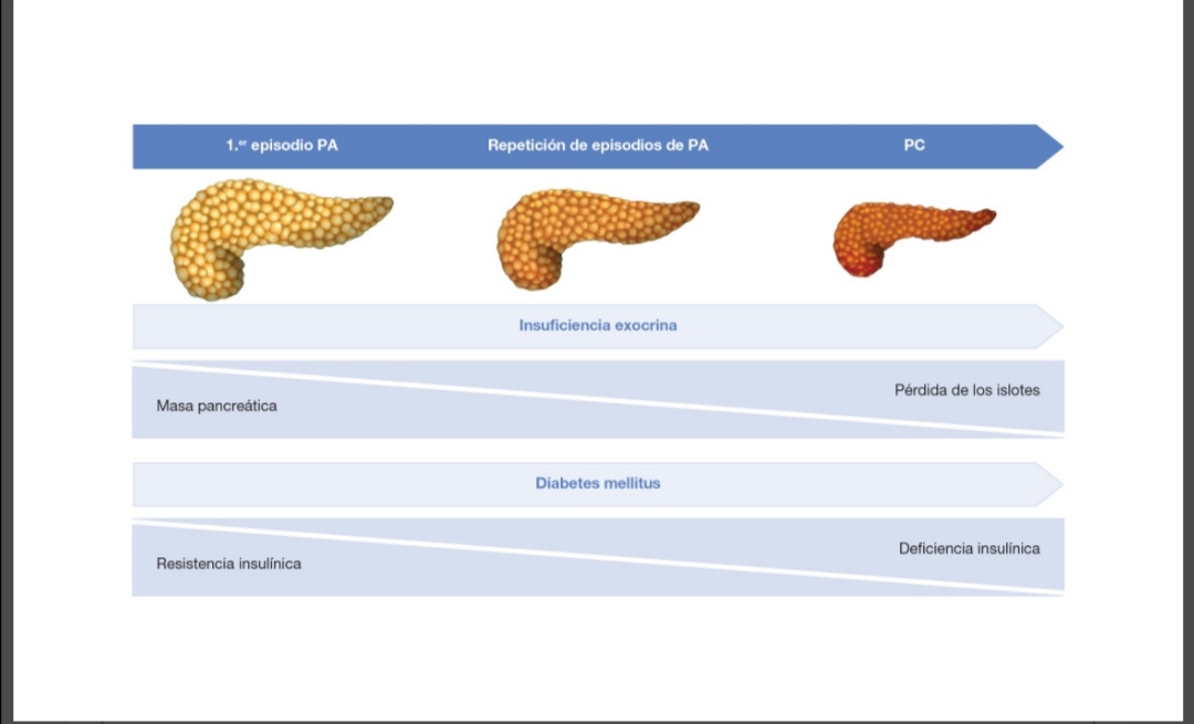 María Durán Martínez (@mduranm67) on Twitter photo Diabetes asociada a enfermedad exocrina del páncreas. Tipo específico de DM, con necesidades terapéuticas propias. Nuevo capítulo Manual SEEN. manual.seen.es/article?id=66c… <a href="/sociedadSEEN/">Sociedad SEEN</a> <a href="/diabeteSEEN/">Área Diabetes SEEN</a> Diabetes asociada a enfermedad exocrina del páncreas. Tipo específico de DM, con necesidades terapéuticas propias. Nuevo capítulo Manual SEEN. manual.seen.es/article?id=66c… <a href="/sociedadSEEN/">Sociedad SEEN</a> <a href="/diabeteSEEN/">Área Diabetes SEEN</a>