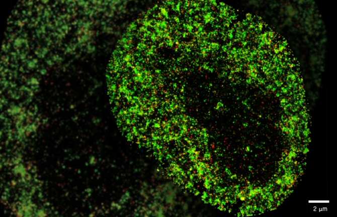 La inteligencia artificial detecta el cáncer y las infecciones virales con precisión nanométrica dlvr.it/TClrzd