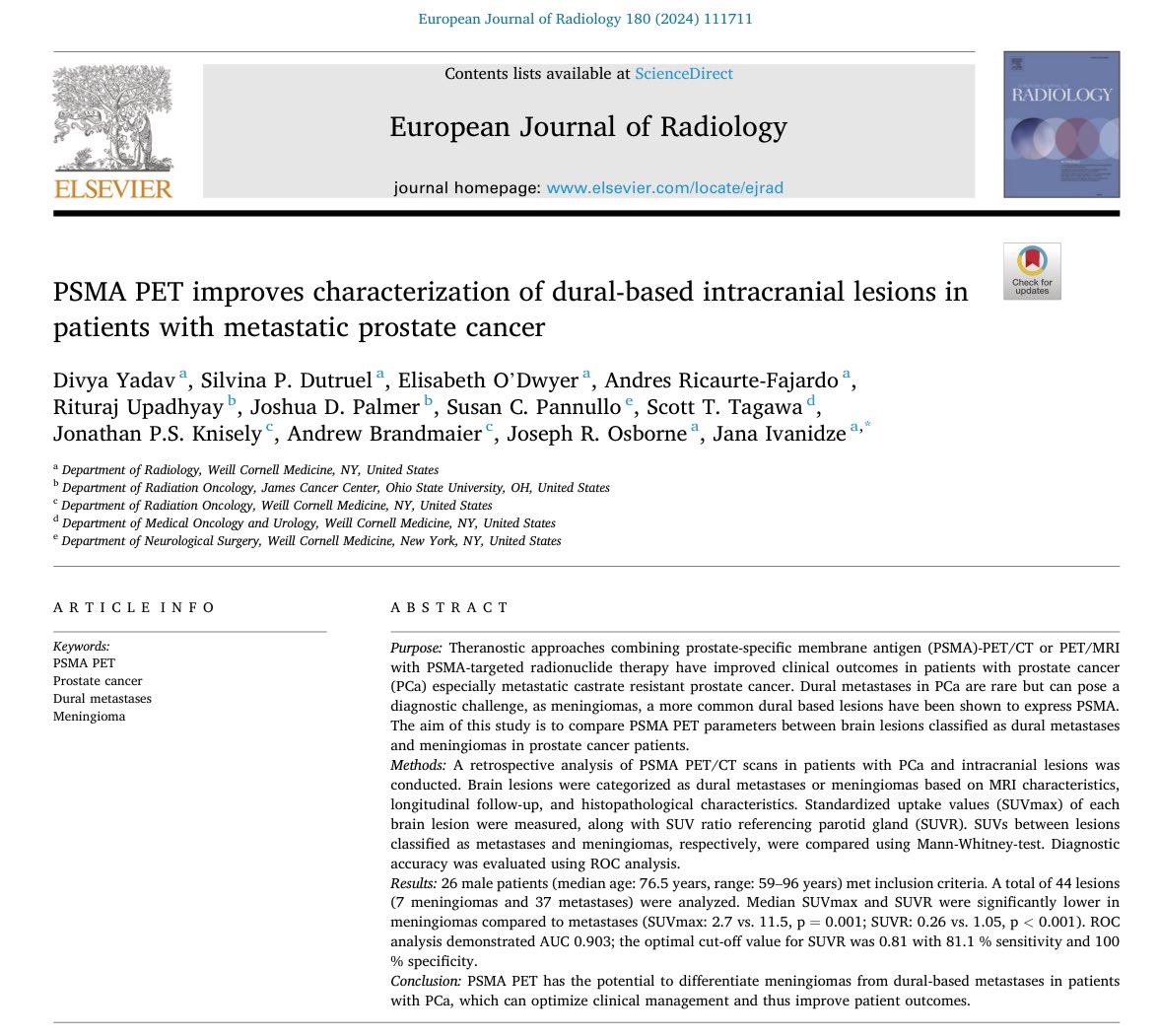 Andres Ricaurte Fajardo (@andresricaurte1) on Twitter photo Thrilled to be part of this study highlighting how dural-based metastasesārare yet significant in prostate cancerācan be distinguished from meningioma, using PSMA PET. This underscores the value of targeted PET in PC.
Congrats <a href="/idivyaMD/">Divya Yadav MD</a> <a href="/jana_ivanidze/">Jana Ivanidze</a>
sciencedirect.com/science/articl⦠Thrilled to be part of this study highlighting how dural-based metastasesārare yet significant in prostate cancerācan be distinguished from meningioma, using PSMA PET. This underscores the value of targeted PET in PC.
Congrats <a href="/idivyaMD/">Divya Yadav MD</a> <a href="/jana_ivanidze/">Jana Ivanidze</a>
sciencedirect.com/science/articlā¦
