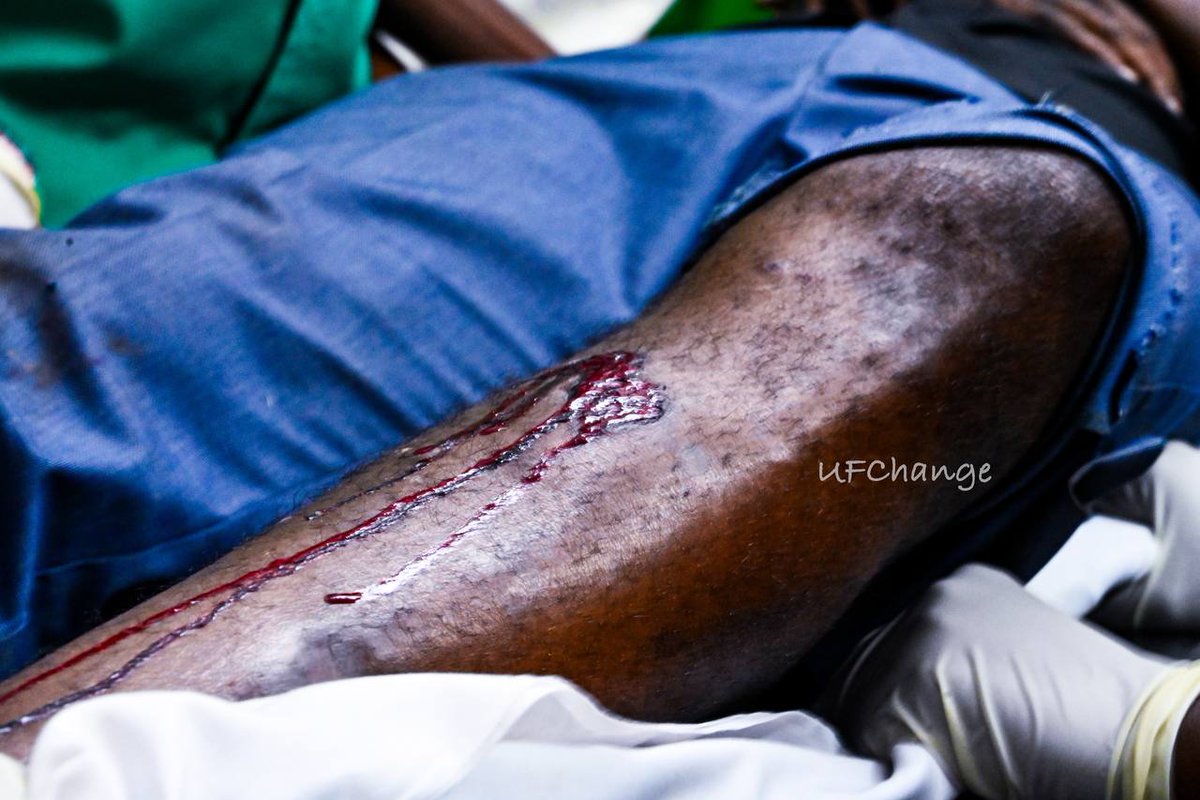 DavidLRubongoya's tweet photo. #FreeUganda 
#StopAbuseOfPowerUganda
#StopGunViolenceUganda 
#BobiWineShot https://t.co/or2IU5lQyp