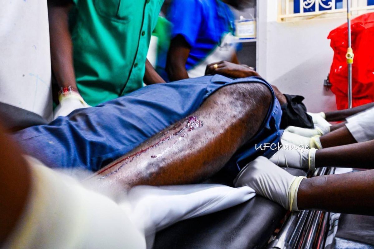 Sudhir Byaruhanga (@sudhirntv) on Twitter photo 1. Was it a live or rubber bullet?
2. Was it a teargas canister or projectile?
<a href="/PoliceUg/">Uganda Police Force</a>
#BobiWineShooting 1. Was it a live or rubber bullet?
2. Was it a teargas canister or projectile?
<a href="/PoliceUg/">Uganda Police Force</a>
#BobiWineShooting