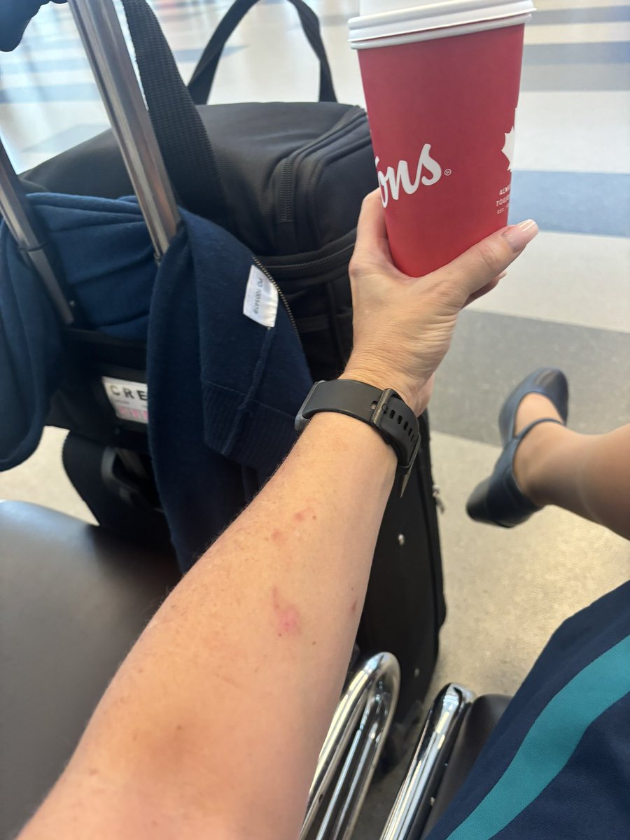 alliebug2000's tweet image. Hey @TimHortons last week in Calgary airport my Tim’s coffee w sleeve ruptured &amp;amp; spilled all over my arm, was even wearing my work blazer, the burns R healing!  Since I’m always in YYC airport 4 work asked 4 double cup 2 not have same issue and got charged for 2nd cup😡