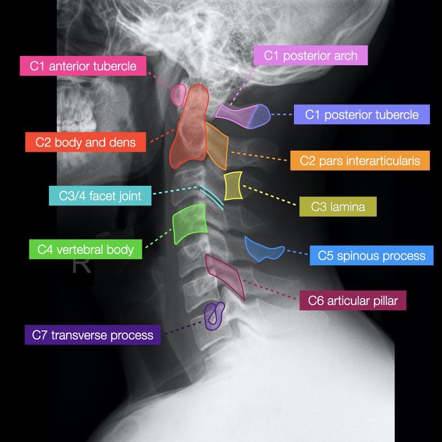 Cervical X-ray🩻💡