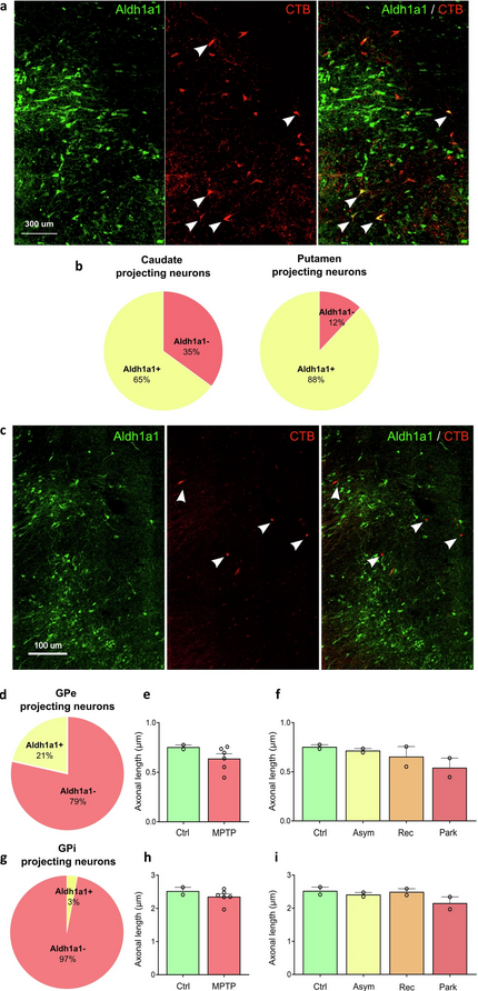 ScienceofPD's tweet photo. Calbindin &amp; Girk2/Aldh1a1 (nigrosome) define resilient vs vulnerable dopaminergic neurons in a primate #Parkinsons (MPTP) model
https://t.co/36PqcbNiVN https://t.co/mREVC9oSzR