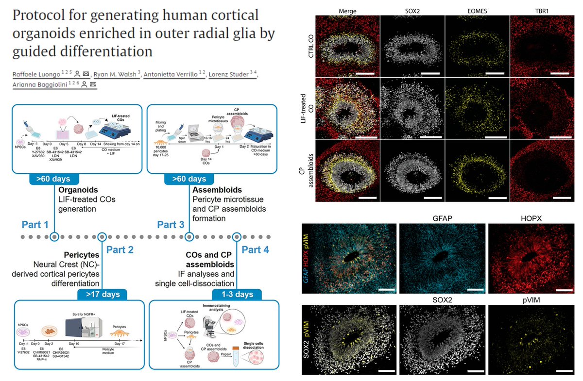 Hao Yin (@haoyin20) on Twitter photo Learning to make #hPSC-derived Cortical #Organoid & Cortico-Pericyte #Assembloid
#Pericyte as a secretory source of LIF
⏫Organized architecture of outer radial glia in Neuronal Rosettes
<a href="/rluongo90/">Raffaele Luongo</a> <a href="/BaggioliniA/">Arianna Baggiolini</a> <a href="/STARProtocols/">STAR Protocols</a> 2024
sciencedirect.com/science/articl… Learning to make #hPSC-derived Cortical #Organoid & Cortico-Pericyte #Assembloid
#Pericyte as a secretory source of LIF
⏫Organized architecture of outer radial glia in Neuronal Rosettes
<a href="/rluongo90/">Raffaele Luongo</a> <a href="/BaggioliniA/">Arianna Baggiolini</a> <a href="/STARProtocols/">STAR Protocols</a> 2024
sciencedirect.com/science/articl…