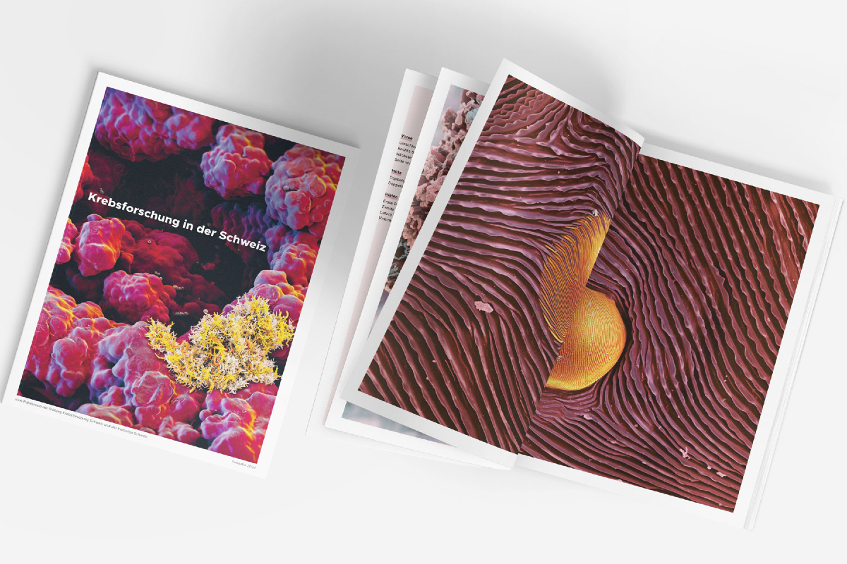 Wofür sich Forschende täglich einsetzen 
Die neuste Ausgabe des Magazins «#Krebsforschung in der Schweiz» stellt von uns unterstützte Projekte vor und zeigt auf 50 Seiten: Krebsforschung lohnt sich.  

➡Forschungsbericht: krebsforschung.ch/ueber-uns/publ…

#damitHeilungzurRegelwird