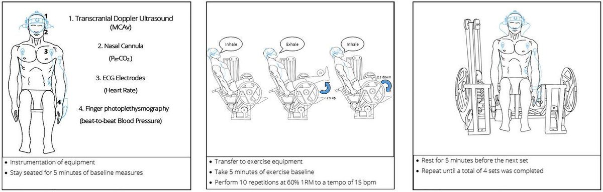 Experimental Physiology (@expphysiol) on Twitter photo Stephanie Korad, <a href="/Blake_G_Perry/">Blake Perry</a> (<a href="/MasseyHlthSc/">MasseyHlthSc</a>) and Toby Mündel (<a href="/BrockKINE/">Brock Kinesiology</a>) investigate the effects of habitual resistance exercise training on cerebrovascular responses to lower body dynamic resistance exercise in a cross-sectional study!
📜buff.ly/3Xs9bgy Stephanie Korad, <a href="/Blake_G_Perry/">Blake Perry</a> (<a href="/MasseyHlthSc/">MasseyHlthSc</a>) and Toby Mündel (<a href="/BrockKINE/">Brock Kinesiology</a>) investigate the effects of habitual resistance exercise training on cerebrovascular responses to lower body dynamic resistance exercise in a cross-sectional study!
📜buff.ly/3Xs9bgy