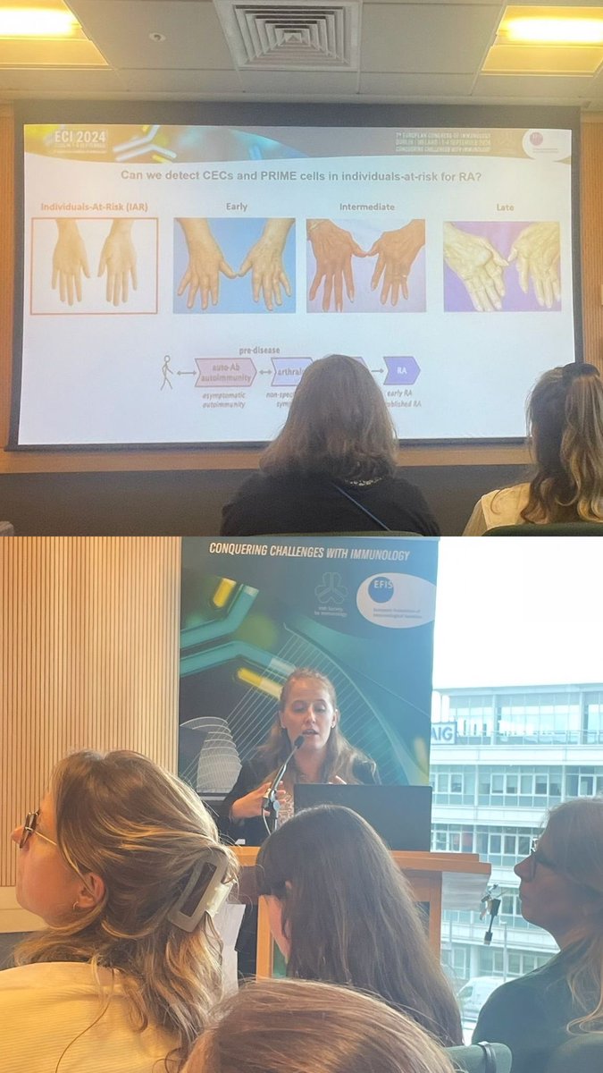 Molecular Rheumatology TCD (@moleculartcd) on Twitter photo Fabulous talk by <a href="/BriBarker20/">Brianne Barker</a> from <a href="/TrinityMed1/">School of Medicine, Trinity College Dublin</a> on circulating stromal cells in individuals at risk of developing RA, potential cellular bio markers on disease onset #ECI2024 #athritis #fibroblast Fabulous talk by <a href="/BriBarker20/">Brianne Barker</a> from <a href="/TrinityMed1/">School of Medicine, Trinity College Dublin</a> on circulating stromal cells in individuals at risk of developing RA, potential cellular bio markers on disease onset #ECI2024 #athritis #fibroblast