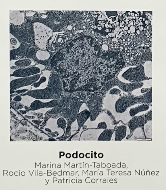 Lipobeta lab (@lipobeta) on Twitter photo Have a look to our picture “Podocito” in the main entrance of the #46congresoSEBBM. Fantastic pictures!!! <a href="/SEBBM_es/">SEBBM</a> <a href="/URJCcientifica/">URJCcientifica</a> <a href="/SEEDO_Research/">SEEDO_Translational Research</a> <a href="/moiractome/">Moir Actome</a> Have a look to our picture “Podocito” in the main entrance of the #46congresoSEBBM. Fantastic pictures!!! <a href="/SEBBM_es/">SEBBM</a> <a href="/URJCcientifica/">URJCcientifica</a> <a href="/SEEDO_Research/">SEEDO_Translational Research</a> <a href="/moiractome/">Moir Actome</a>