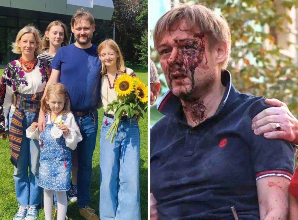 World politics doesn't care. We can't fire missiles back on Ruzzian airfields!
This man from Lviv lost three daughters and his wife at once. Ruzzia killed them in their own home. 
Does Ukrainian life matter? Does Ukrainian destiny matter? What should this man do next? Do you know