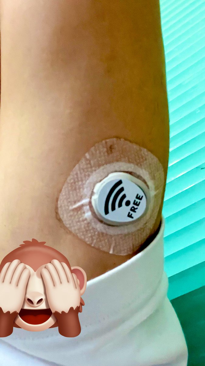 totongasun's tweet image. 風邪引いてる間にセンサー交換あったんすよ！
G7のステッカー難しいっす〜😂
前より小さくなったし
一体型になったし
…🤔着けてるのは良いことしかないな✨ww

デザインはシンプルにせざるを得ないw
貼るのも難しいw

とりあえずみんな電波無かったら言って〜www
#DexcomG7
#自作ステッカー