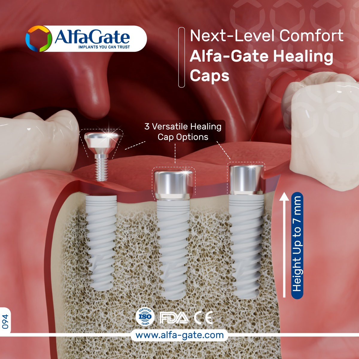 Alfa_gate's tweet image. Transform your healing process with our versatile healing caps! Select from three types and heights up to 7 mm to achieve your perfect fit. 
Learn more➡️: alfa-gate.com/prosthetics/
#prostheticscare #customfit #prostheticsolutions #alfagate #dentalimplants