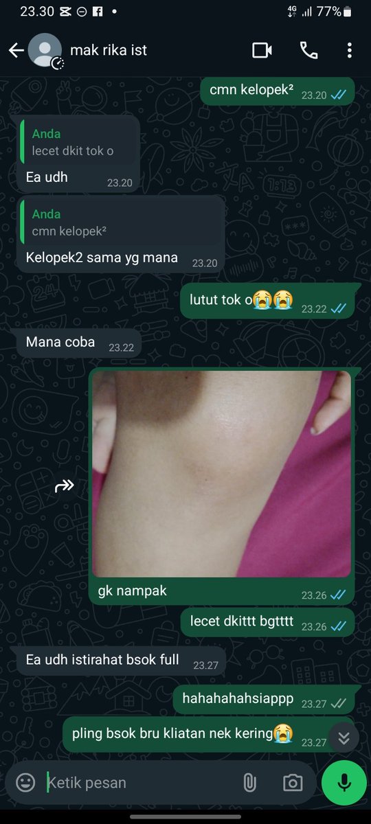 bobituq's tweet photo. luka sekecil ini berkelahi dg aku yg lebay https://t.co/jQzzFFRcbx
