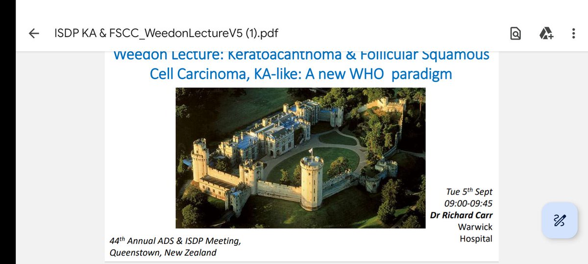 Weedon Lecture in 6 h. Dedicated to both Dr David Weedon &amp; my beloved mentor Dr McKee, legends of #Dermpath 20+ year obsession &amp; CLIN-H&amp;E-IHC in DX of KA &amp; FSCC-KAL. Please 🙏❤️🙏 re-tweet my cases &amp; share with colleagues to make sure KA is retained as dx-entity