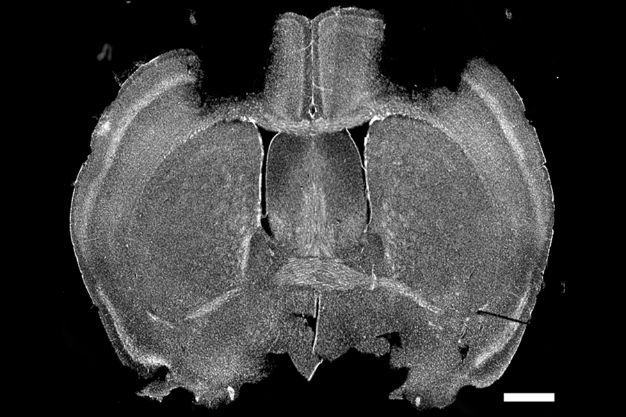 CMU Mellon College of Science (@cmuscience) on Twitter photo Researchers in <a href="/YttriLab/">The Yttri Lab</a> discovered how the motor cortex and striatum work together to create movement.
cmu.edu/mcs/news-event… Researchers in <a href="/YttriLab/">The Yttri Lab</a> discovered how the motor cortex and striatum work together to create movement.
cmu.edu/mcs/news-event…