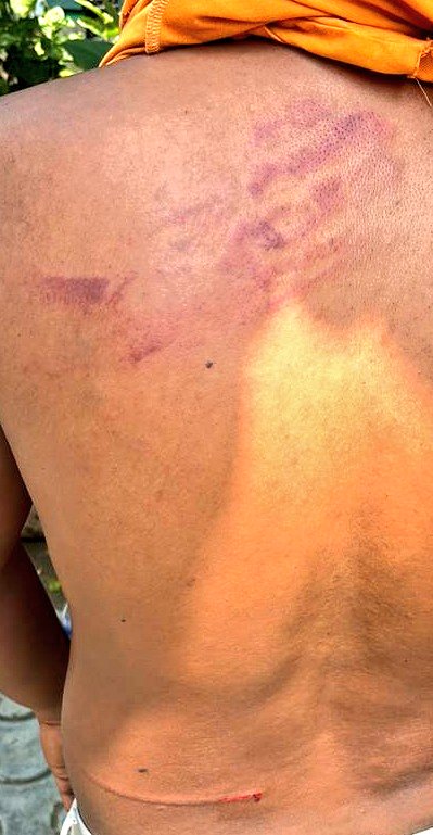 DeepikaBhardwaj's tweet image. 🆘 DELHI : Family of a man has been brutally attacked by his wife and her family inside Saket Court premises. Elderly mother of man slapped &amp;amp; assaulted by wife&apos;s brother. About 50 goons brought by wife attacked but IO isn&apos;t willing to even lodge an FIR 

WHAT IS THE SAFETY OF…