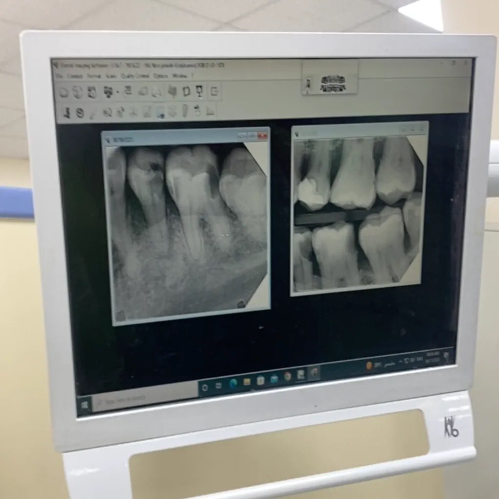 _iana_97's tweet photo. عشوائيات DA🦷 https://t.co/Scm92n8wA5