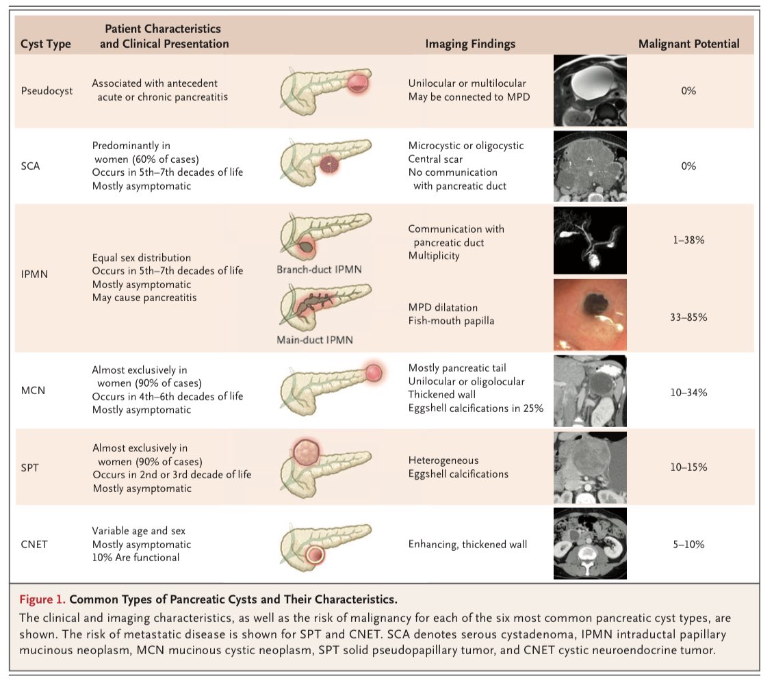 Faisal (@faisaloa) on Twitter photo Pancreatic cystic lesion <a href="/NEJM/">NEJM</a> 👇🏿
nejm.org/doi/full/10.10… Pancreatic cystic lesion <a href="/NEJM/">NEJM</a> 👇🏿
nejm.org/doi/full/10.10…