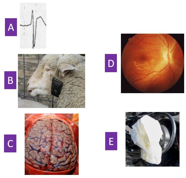 Steve Curry (@stevecurrymd) on Twitter photo MedTox Fellows - an easy inhibitors of oxidative phosphorylation association quiz. Name the inhibitor associated with each lettered figure. <a href="/ToxAndHound/">The Tox And The Hound</a> MedTox Fellows - an easy inhibitors of oxidative phosphorylation association quiz. Name the inhibitor associated with each lettered figure. <a href="/ToxAndHound/">The Tox And The Hound</a>