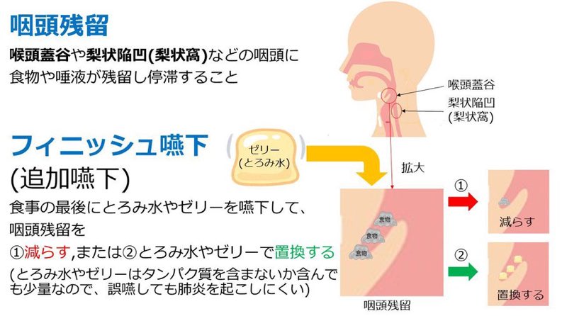 咽頭残留とフィニッシュ嚥下

嚥下障害のある方で食事の最後に水やゼリーを一口嚥下して下さいという指示(フィニッシュ嚥下)が出ていることがあると思います。この指示には

①咽頭残留を減らす
②咽頭残留をとろみ水やゼリーに置換する