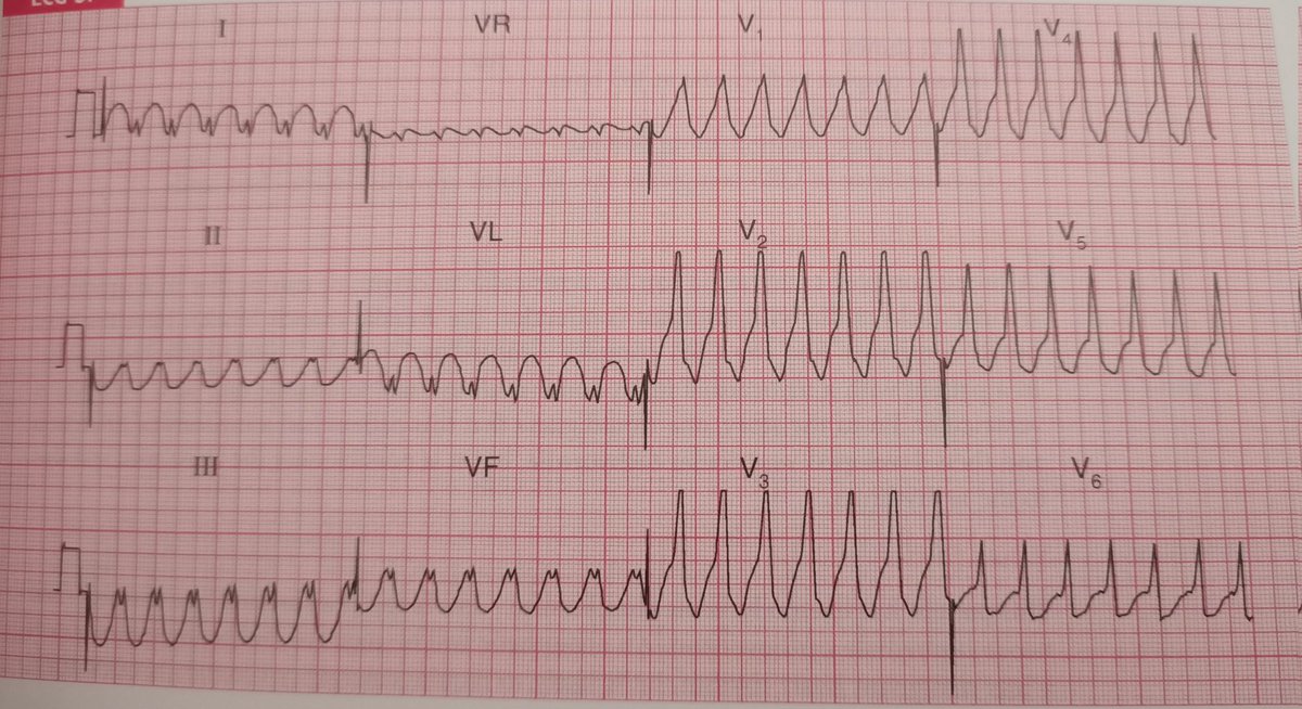 Rhythm??
Please with explanation.