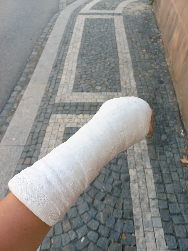 After my vacation I had enough luck to break my joint 😂 My life is changing so fast these days...
Its gonna take me some time to recover.