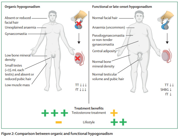 TheLancetEndo's tweet photo. Male #hypogonadism is a clinical syndrome of impaired #androgen production from the #testes that is usually associated with impaired #spermatogenesis and #subfertility https://t.co/k5ZVLahhjz #MensHealth https://t.co/rk6opWP44x