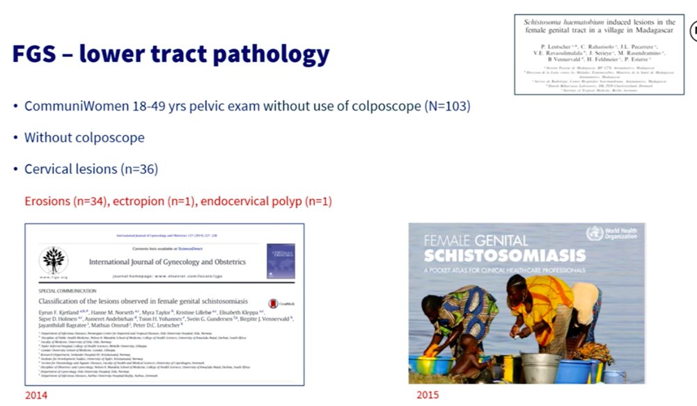 Global Schistosomiasis Alliance tweet media