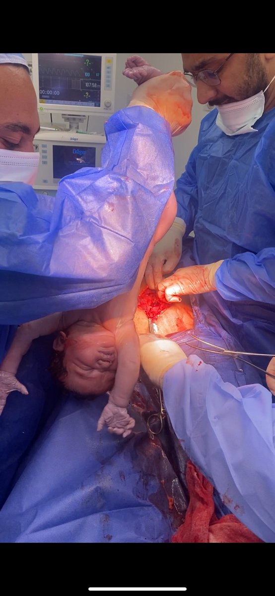 1st cesarean section 
Assist by R/mustafa elnagm❤️❤️❤️