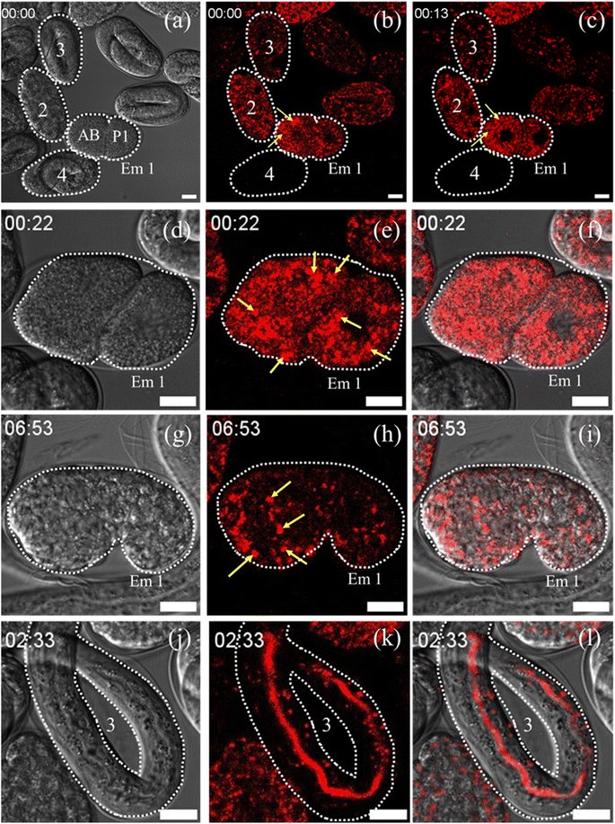 ckn_lab_IIT's tweet photo. Our article titled "A zinc metal complex as an NIR emissive probe for real-time dynamics and in vivo embryogenic evolution of lysosomes using super-resolution microscopy" got published in @ChemicalScience. Congrats to Abdul, Kush &amp; Bodhi for this work. https://t.co/BcdcQXz6dR https://t.co/lDApDQn00B