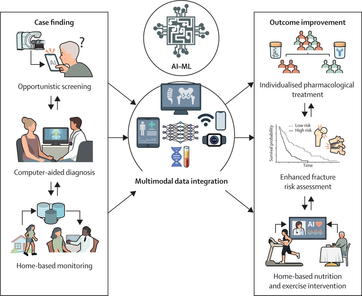 TheLancet's tweet image. Osteoporotic fractures are a major health challenge in older adults, with better case-finding and fracture risk assessment strategies needed.

In @TheLancetEndo, authors explore the potential of AI and machine learning to transform osteoporosis management: hubs.li/Q02NNYGV0