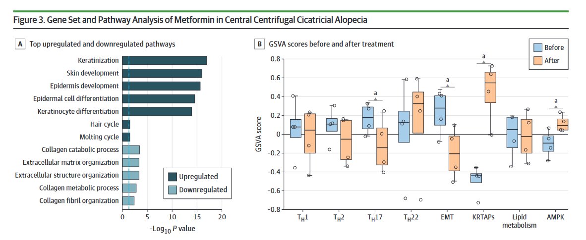 JAMA Dermatology (@jamaderm) on Twitter photo In a case series of central centrifugal cicatricial alopecia, low-dose oral metformin downregulated profibrosis and upregulated hair growth signatures. Clinical improvement and hair regrowth were observed, suggesting metformin's therapeutic potential. ja.ma/4dQzwL8 In a case series of central centrifugal cicatricial alopecia, low-dose oral metformin downregulated profibrosis and upregulated hair growth signatures. Clinical improvement and hair regrowth were observed, suggesting metformin's therapeutic potential. ja.ma/4dQzwL8