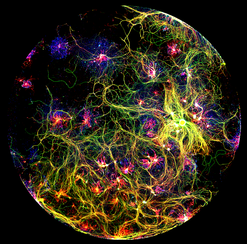 Chan Zuckerberg Initiative (@chanzuckerberg) on Twitter photo Get lost in twin neuronal universes! 😍  💫
These images taken by @FelipeCourtg with a fluorescence microscope shows neuron-glia crosstalk, which is a key phenomenon for understanding brain diseases like Alzheimer's and Parkinson's Get lost in twin neuronal universes! 😍  💫
These images taken by @FelipeCourtg with a fluorescence microscope shows neuron-glia crosstalk, which is a key phenomenon for understanding brain diseases like Alzheimer's and Parkinson's