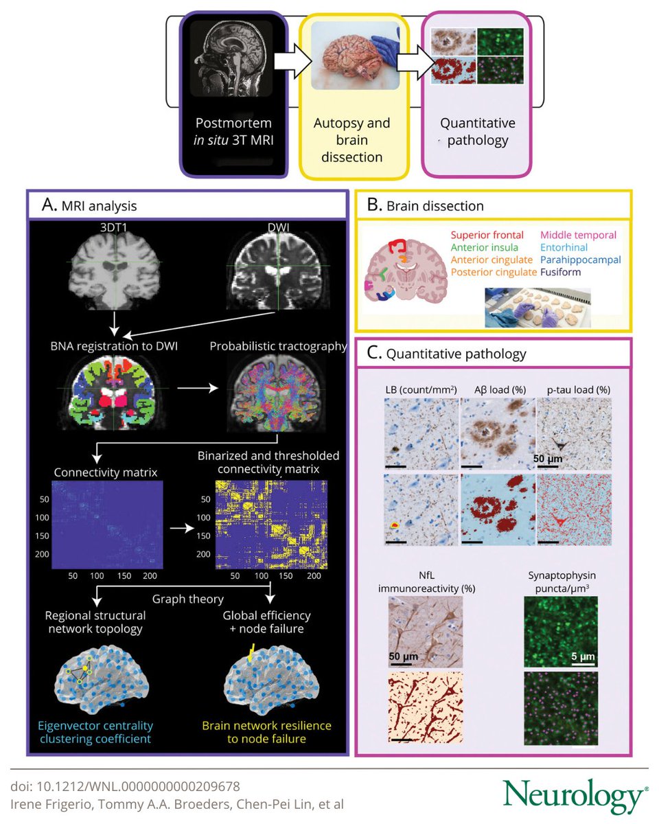 In this study, the authors investigated whether neuropathologic processes contribute to brain regional topologic properties of integration and segregation and brain network resilience in #ParkinsonDisease: bit.ly/3WuQBD1

#NeuroTwitter