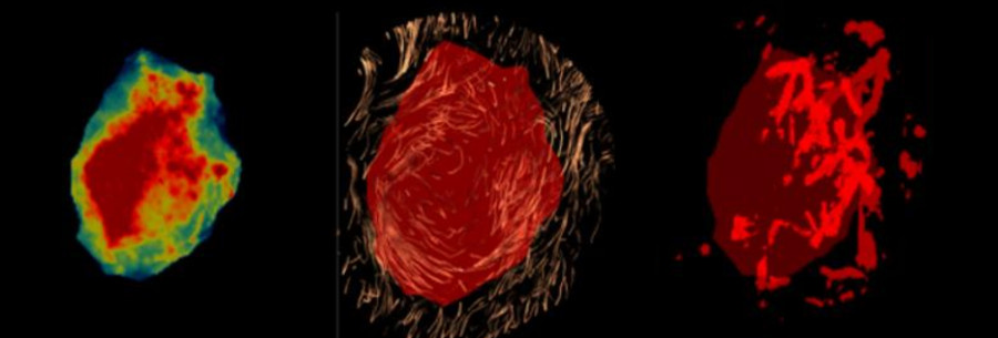 Physics for Medicine Paris (@physmedparis) on Twitter photo Proud to announce that Béatrice Berthon-Walker has been awarded an <a href="/ERC_Research/">European Research Council (ERC)</a> Starting Grant! Project MUSCAD aims to improve breast cancer diagnosis using 3D multiparametric ultrasound.
<a href="/Inserm/">Inserm</a> <a href="/ESPCI_Paris/">ESPCI Paris - PSL</a> <a href="/psl_univ/">Université PSL</a> <a href="/CNRS/">CNRS 🌍</a> Proud to announce that Béatrice Berthon-Walker has been awarded an <a href="/ERC_Research/">European Research Council (ERC)</a> Starting Grant! Project MUSCAD aims to improve breast cancer diagnosis using 3D multiparametric ultrasound.
<a href="/Inserm/">Inserm</a> <a href="/ESPCI_Paris/">ESPCI Paris - PSL</a> <a href="/psl_univ/">Université PSL</a> <a href="/CNRS/">CNRS 🌍</a>