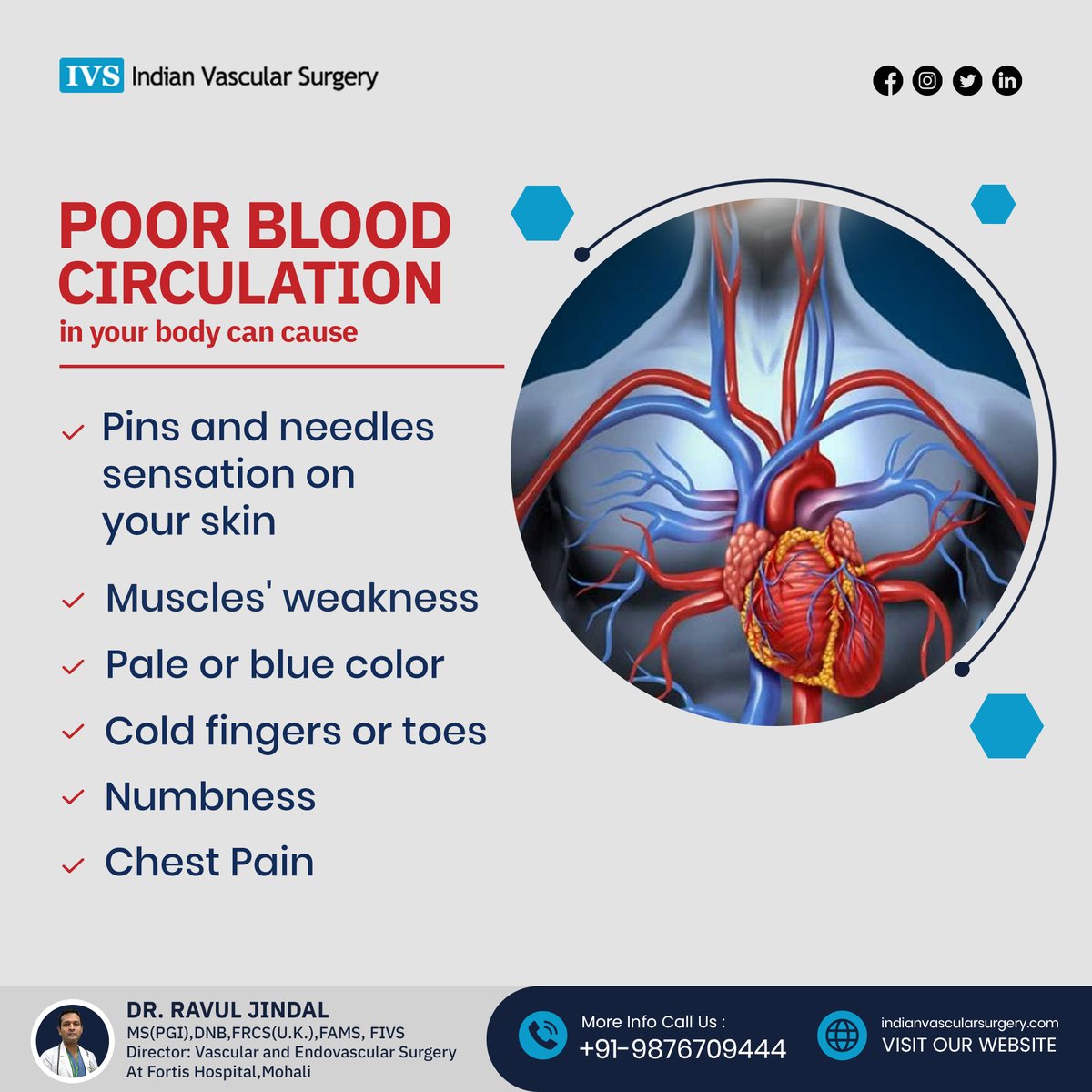 DrRavulJindal's tweet image. Poor circulation is caused by fatty deposits, blood clots, or narrowed vessels. This hinders blood flow. Exercise and a healthy diet can help prevent these issues.
bit.ly/3VPYtwJ
#Fattydeposits #bloodclots #poorbloodcirculation #narrowedvessels #chestpain