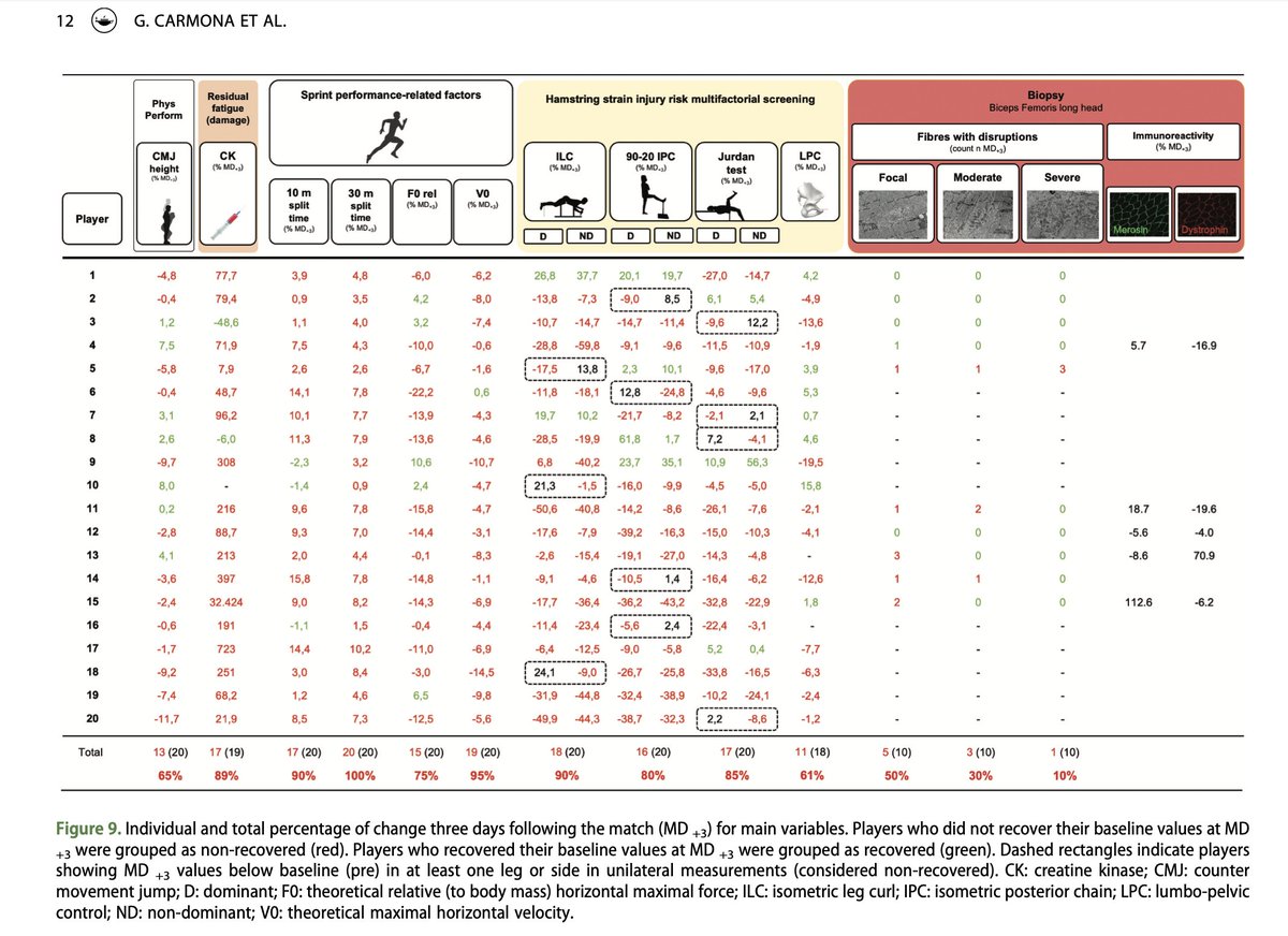 JB Morin (@jb_morin) on Twitter photo Hamstring risk factors: post ⚽️ match, multifactorial individualised study 🔬
So many results on hamstring tissue, sprint perf, mechanics, pelvis & more 📊🧐
👏authors & <a href="/zentrumsport/">ZENTRUM SPORT</a> once more on top of the game
Happy this is published <a href="/JSportsSci/">Journal of Sports Sciences</a> ✅
doi.org/10.1080/026404… Hamstring risk factors: post ⚽️ match, multifactorial individualised study 🔬
So many results on hamstring tissue, sprint perf, mechanics, pelvis & more 📊🧐
👏authors & <a href="/zentrumsport/">ZENTRUM SPORT</a> once more on top of the game
Happy this is published <a href="/JSportsSci/">Journal of Sports Sciences</a> ✅
doi.org/10.1080/026404…