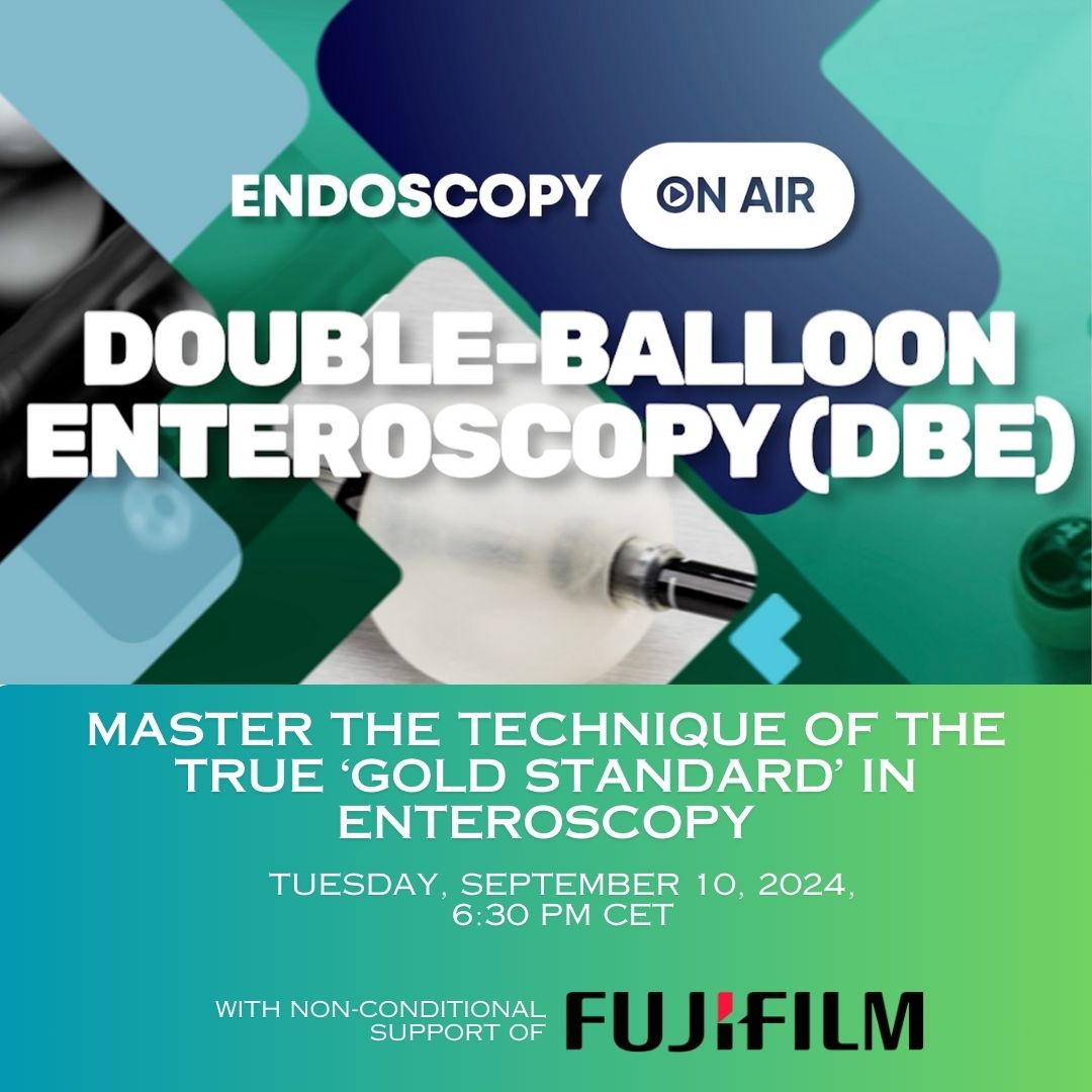 Endoscopy On Air (@endoscopyoa) on Twitter photo Our event, "Double-Balloon #Enteroscopy (DBE) - Master the Technique of the True ‘Gold Standard’ in Enteroscopy," will be live soon! ⏰
Led by Prof. <a href="/AEMLondon/">Edward J. Despott</a> and featuring Prof. Hironori Yamamoto as key guest, this is an event you won’t want to miss. 👀
Register now to ensure Our event, "Double-Balloon #Enteroscopy (DBE) - Master the Technique of the True ‘Gold Standard’ in Enteroscopy," will be live soon! ⏰
Led by Prof. <a href="/AEMLondon/">Edward J. Despott</a> and featuring Prof. Hironori Yamamoto as key guest, this is an event you won’t want to miss. 👀
Register now to ensure