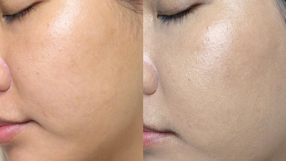 9.9 นี้ใครคิดไม่ออกจะช้อปอะไรดี ขอป้ายยา คุชชั่นเซรั่มน้องใหม่จาก Her Hyness เลยค่าา จากปกติราคา 1,390.- เหลือเพียง 890.- เต้าอั้นน แล้วยังมีตลับรีฟิลให้ด้วย ใครที่ผิวแพ้ง่าย หรือเป็นสิวง่ายต้องมีแล้ว เบลอผิวได้ดี คุมมัน เรียบเนียน ปกปิด แต่เนื้อคุชชั่นบางเบามากๆ ติดทนนาวนานถึง