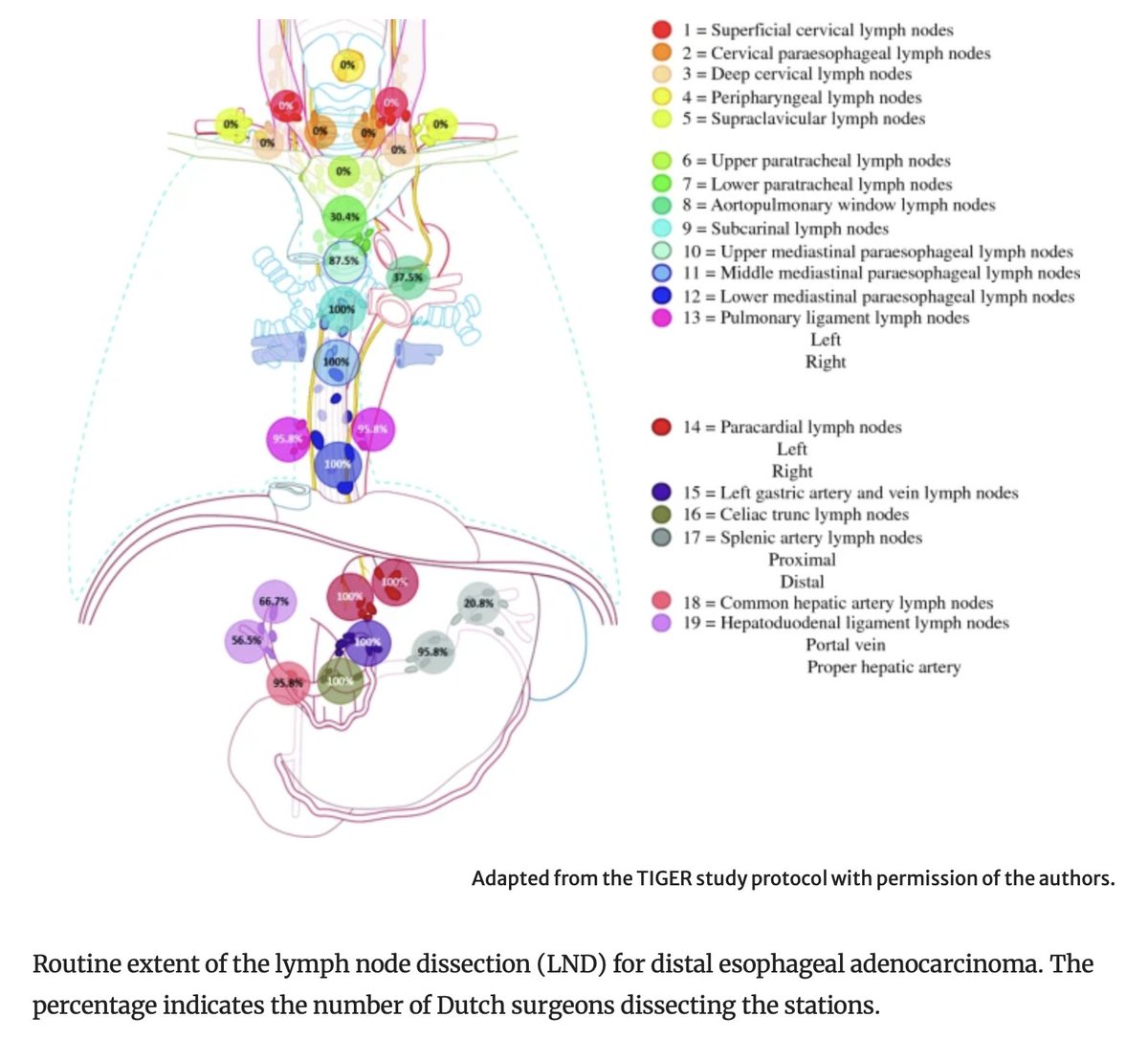 Annals of Surgical Oncology (@annsurgoncol) on Twitter photo September Issue: Extent and Boundaries of #LymphNode Stations During Minimally Invasive #Esophagectomy : A Survey Among Dutch Esophageal Surgeons
rdcu.be/dS7l2
<a href="/ZaidAbdelsattar/">Zaid Abdelsattar, MD, MS, FACS</a>
<a href="/SyedAAhmad5/">Syed A. Ahmad</a> September Issue: Extent and Boundaries of #LymphNode Stations During Minimally Invasive #Esophagectomy : A Survey Among Dutch Esophageal Surgeons
rdcu.be/dS7l2
<a href="/ZaidAbdelsattar/">Zaid Abdelsattar, MD, MS, FACS</a>
<a href="/SyedAAhmad5/">Syed A. Ahmad</a>