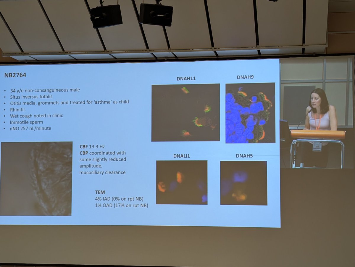 "Not all your tests might appear abnormal at first instance" Important message by <a href="/_Claire_Jackson/">Dr Claire Jackson 🔬</a> <a href="/beatpcd/">BEAT-PCD (ERS CRC)</a> #BeatPCD2024